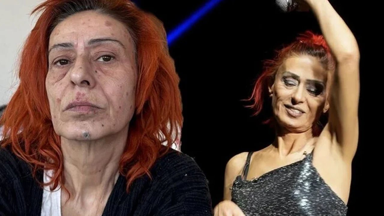 Yıldız Tilbe'nin yüzünde yanıklar oluşmuştu; Olayın perde arkasını anlattı 18 500108