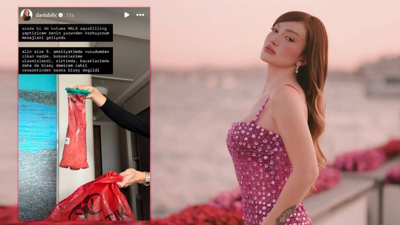 Vücudundan Çıkan Dolgu Herkesi Şaşkına Çevirdi! 16 551790